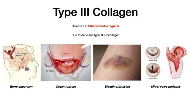 Types Of Collagen