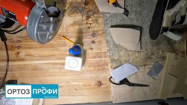 Рецидив стопы при косолапости, модификация обуви. смотреть онлайн