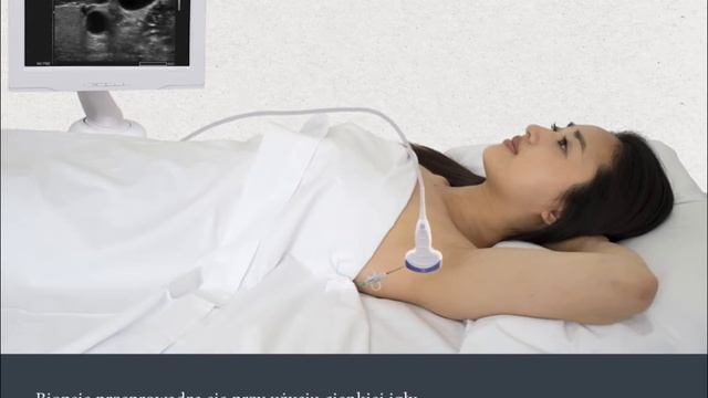 Lymph Node Biopsy (Polish subtitles) смотреть онлайн