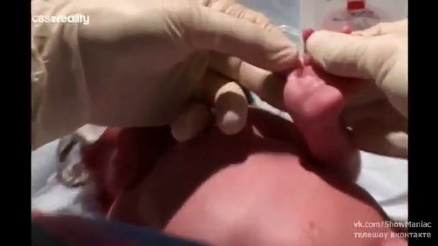 Новорожденные: трудные роды 14