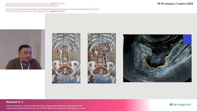 "Гинекология без границ. Репродуктолог+Хирург" смотреть онлайн