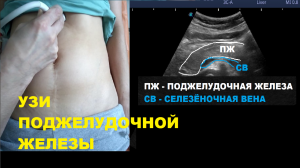 Как проводиться УЗИ поджелудочной железы?