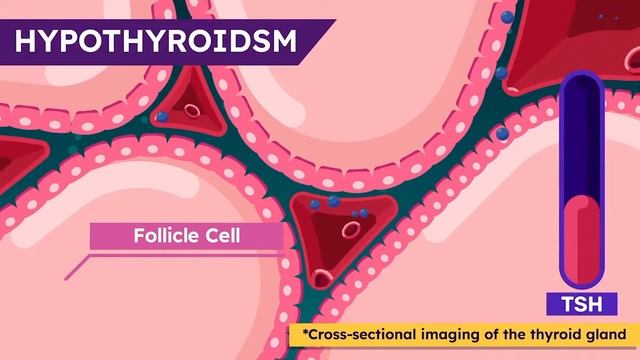 The Lump in The Neck: A Swollen Lymph Node or Else? Gaaly Ki Sojan Kia Hai? | Part 2 | Urdu/Hindi смотреть онлайн