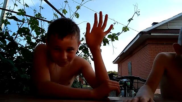 Сломал руку смотреть онлайн