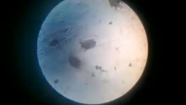 ушной клещ смотреть онлайн