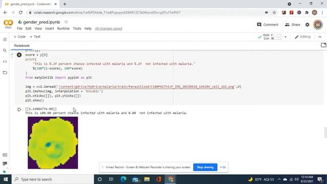 Build an very accurate convolutional neural network to predict malaria or not on test images смотреть онлайн