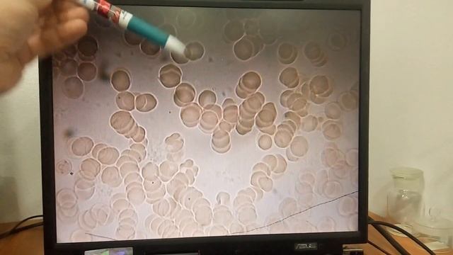 Что можно увидеть под микроскопом? Увеличение 1800 раз! Надо ли делать очистку организма? смотреть онлайн