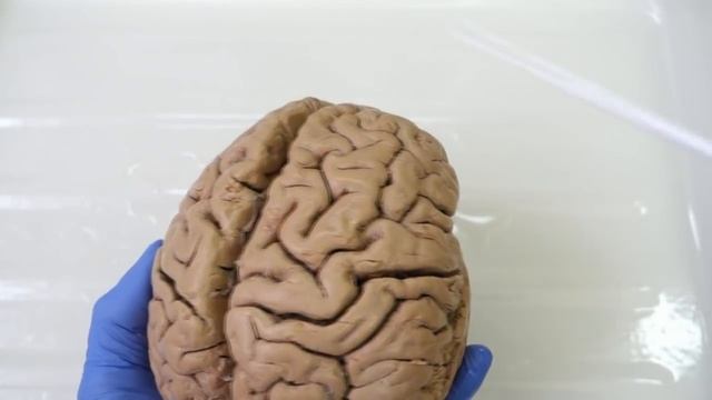 Борозды и извилины полушарий (верхне-латеральная поверхность)