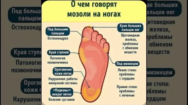 Психология здоровья: О чем говорят мозоли на ногах/25.11.22 23:13 смотреть онлайн