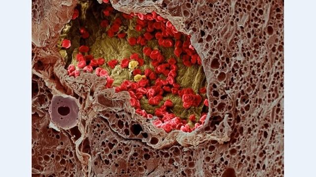 Хиджама и теория природы онкологии alhajam.ru смотреть онлайн