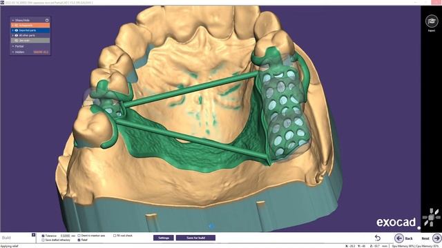 EXOCAD PartialCad Прямая трансляция из Дискорда. Моделировка бюгельных каркасов под печать. смотреть онлайн