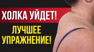 Как убрать холку на шее за 3 минуты! / 5 упражнений  от «вдовьего горба»