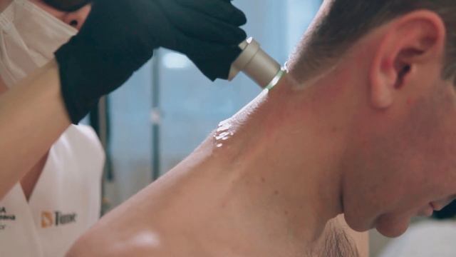 Лазерная эпиляция DEKA MOTUS MOVEO (мужская шея) смотреть онлайн