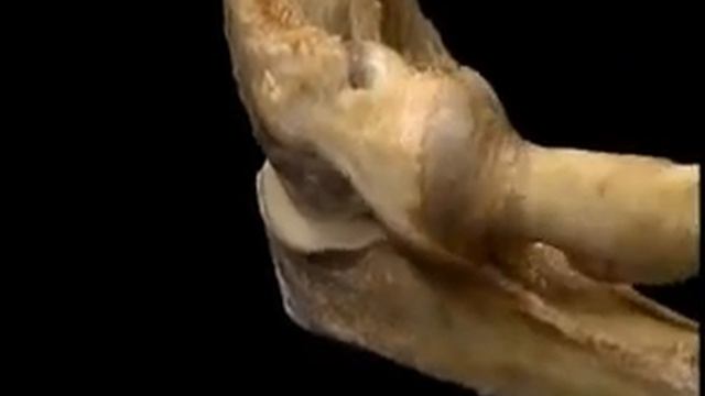 Видео. Анатомия человека. Локоть. смотреть онлайн