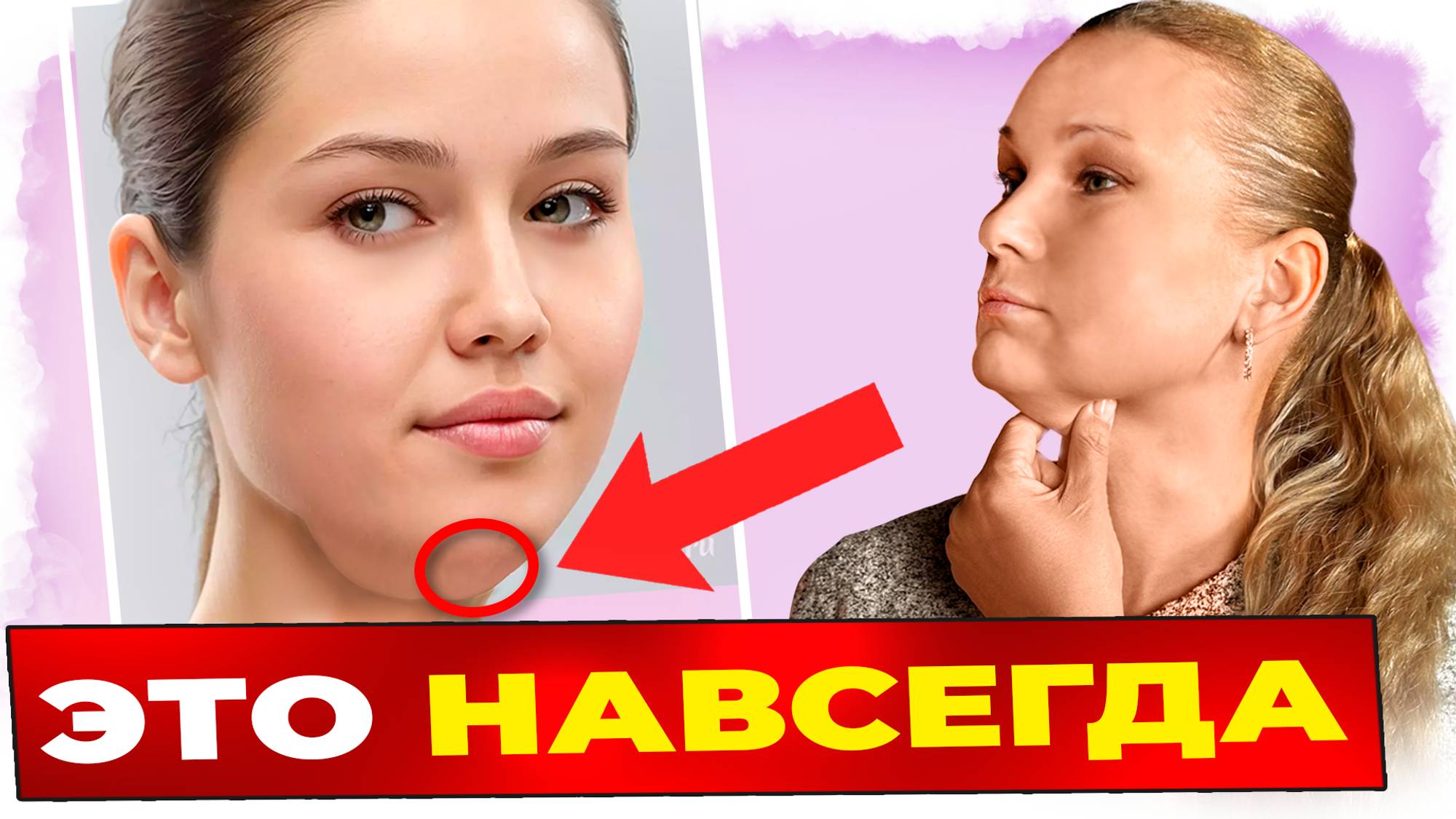 Второй подбородок