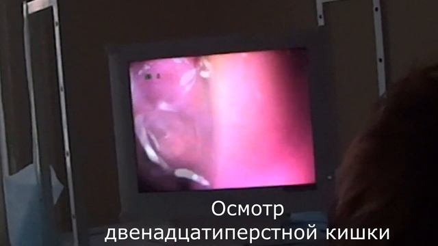 Гастроскопия в 