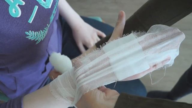 Оказание первой помощи при термическом ожоге смотреть онлайн