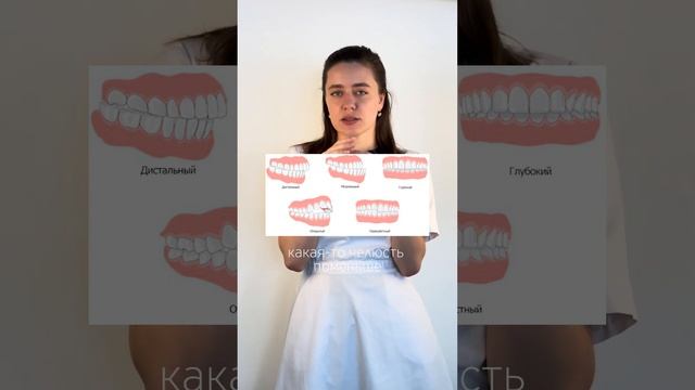 ПОЧЕМУ БРЕКЕТЫ НОСЯТ ТАК ДОЛГО? #брекетысроки #брекетытмн #ортодонтиябрекеты #вопросыортодонтии