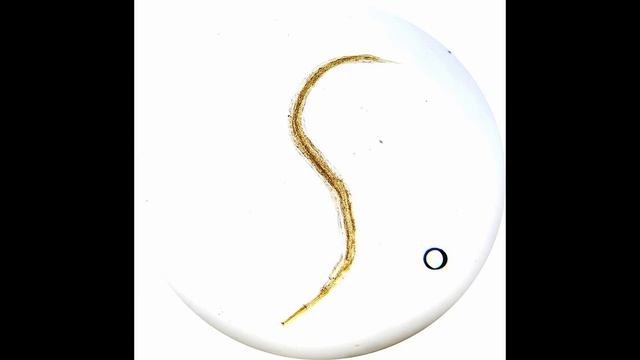 Острица Человеческая (Enterobius vermicularis) Морфология, Жизненный Цикл, Диагностика, Профилактик смотреть онлайн