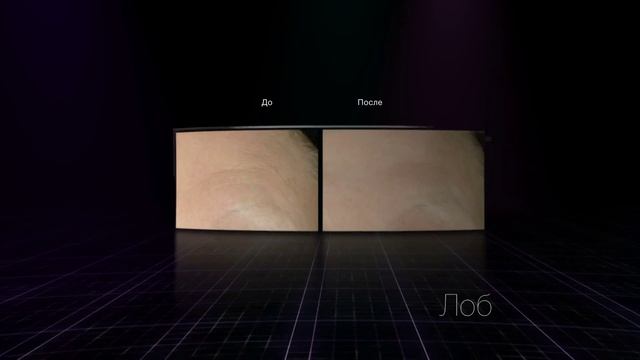 Крем-филлер для глубоких морщин Volu-Fill смотреть онлайн
