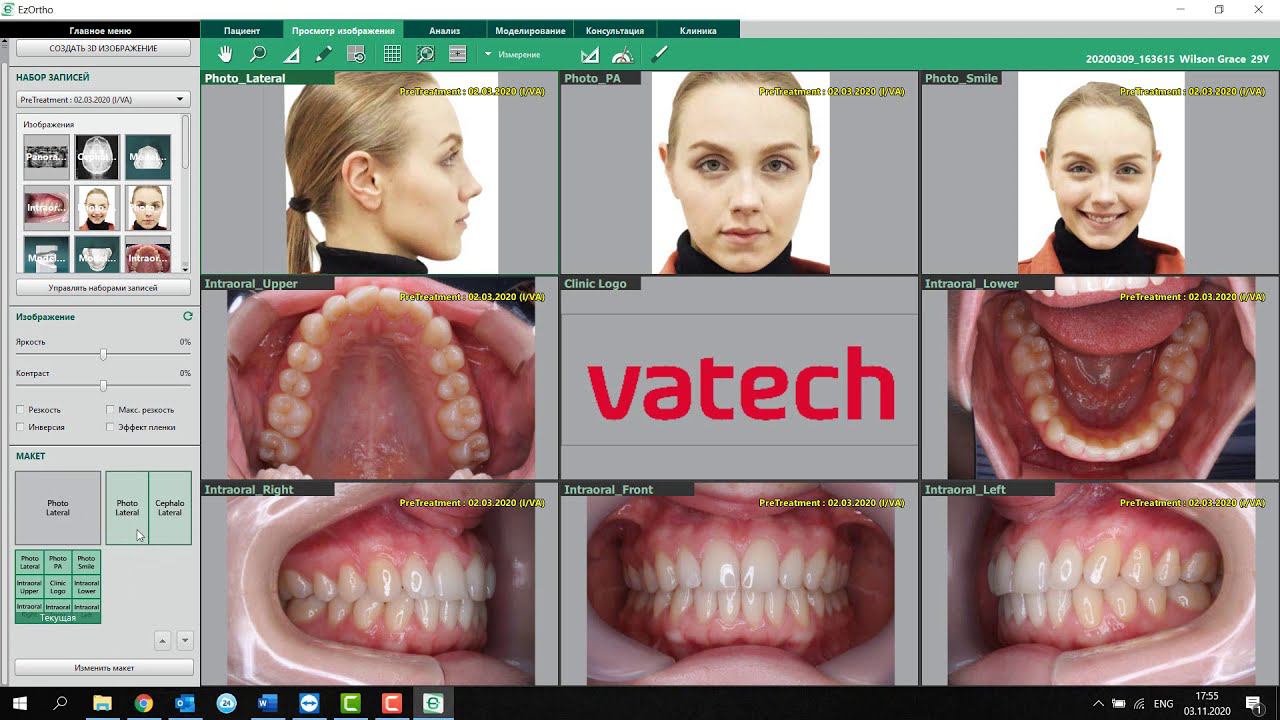 Вводные сведения для начала работы с EzOrtho смотреть онлайн