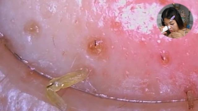 VIRAL *TIKTOK* BLACKHEAD & CAMERA SUCTION! (you need this!!!) смотреть онлайн