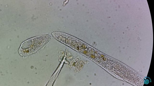 Инфузория Spirostomum смотреть онлайн
