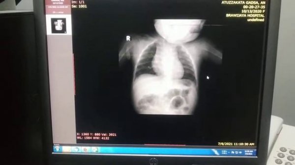 TUTORIAL DICOM Converter to JPG image converter - FREE ❗❗ no ? SOFTWARE no CRACK