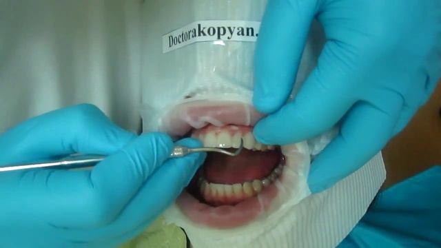 Люминиры установка. Часть 3 смотреть онлайн