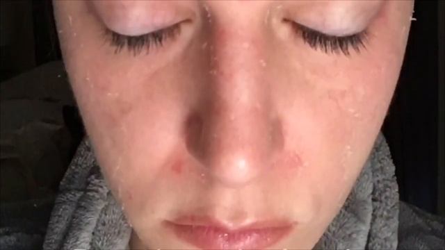 Image Skincare Perfection Lift Chemical Peel With Esthetician Robin