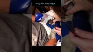 из подкожного покрова белки достают личинки