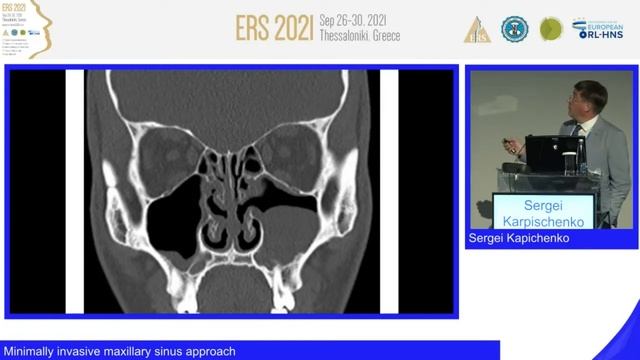 ERS Thessaloniki 2021, Minimally invasive maxillary sinus approach, Sergei Kapichenko смотреть онлайн