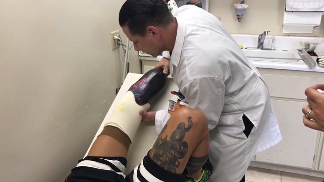 The First Steps On The Prosthesis. Первые шаги на протезе. Кима Дима. Ощущения. Радость.