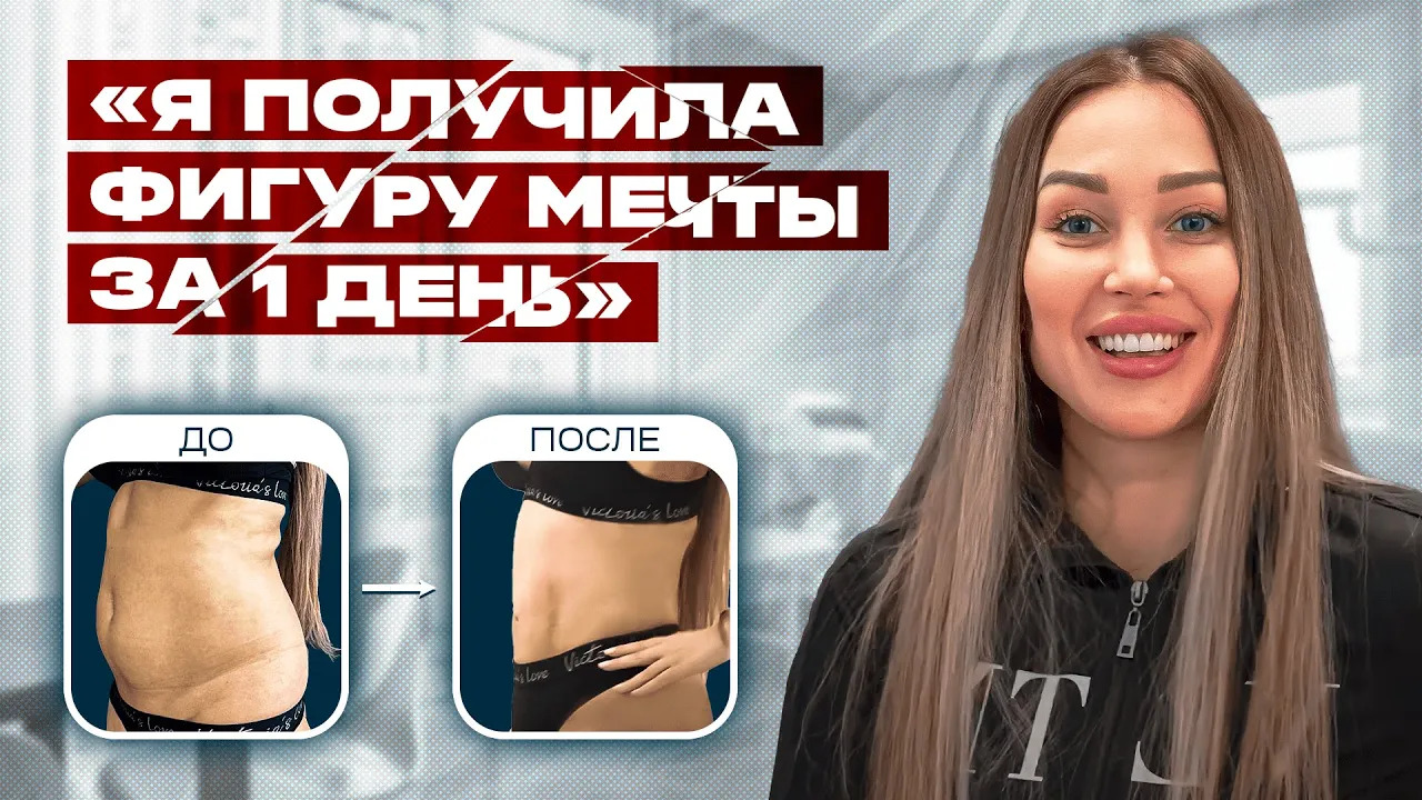 Идеальная женская фигура за день! Реальный отзыв о липосакции! смотреть онлайн