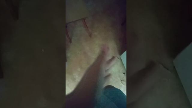я подвернула ногу) смотреть онлайн
