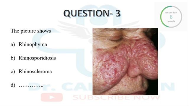 FMGE DECEMBER 2020 EXAM | ALL IN ONE EDITION | COMPLETE RECALL MCQ WITH EXPLANATIONS | DR. CAPRICOR смотреть онлайн