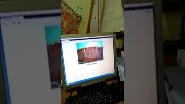 Гистология дно и пилорическая часть желудка (Пищеварительная система) смотреть онлайн