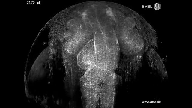 Zebrafish Brain Developing