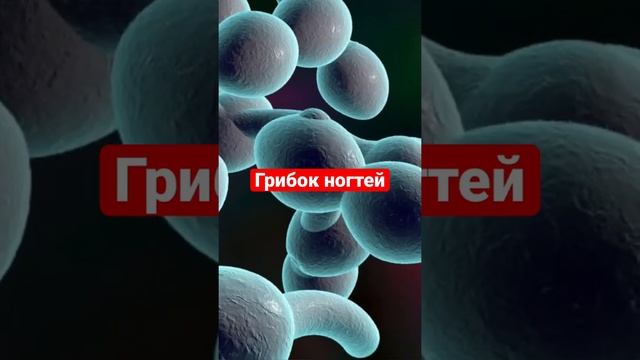 Почему белые пятна на ногтях? смотреть онлайн