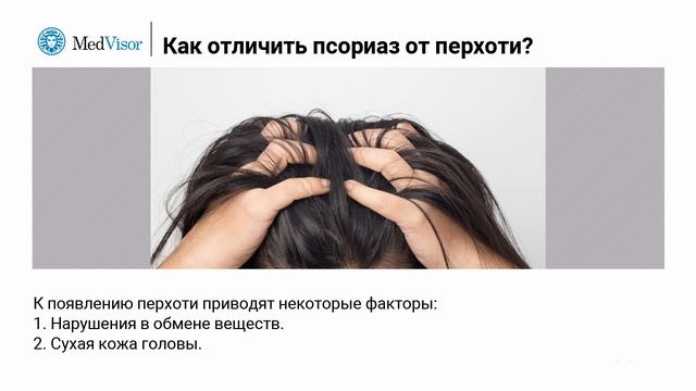 Как отличить псориаз от перхоти? смотреть онлайн