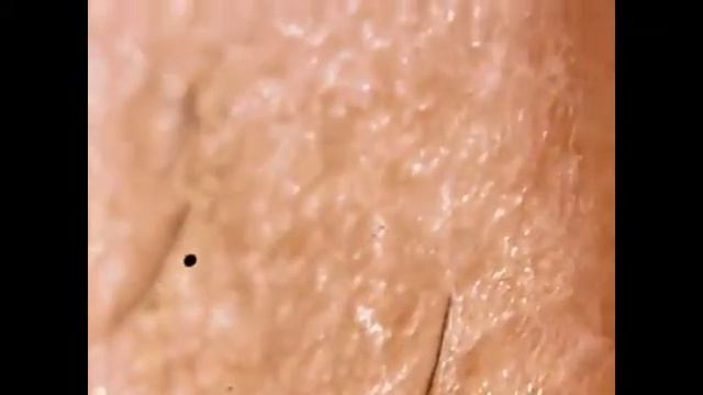 Замороженный шиповник | Под микроскопом | Увеличение 80х смотреть онлайн