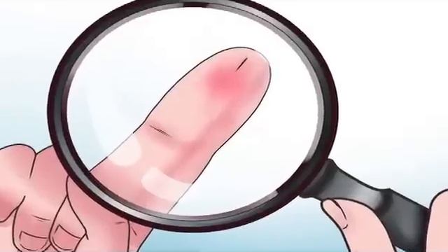 Aprenda a quitarse las astillas con bicarbonato de sodio | Salud смотреть онлайн