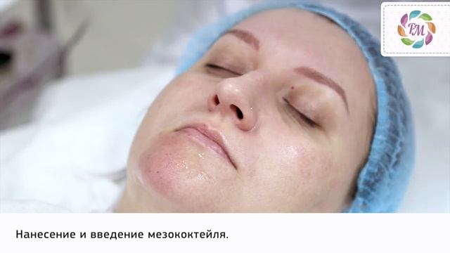 Фракционная мезотерапия лица | Процедура Роял Медик