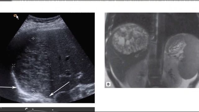 GIT MC GRAW HILL RADIOLOGY BOOKS FRCR(3) смотреть онлайн