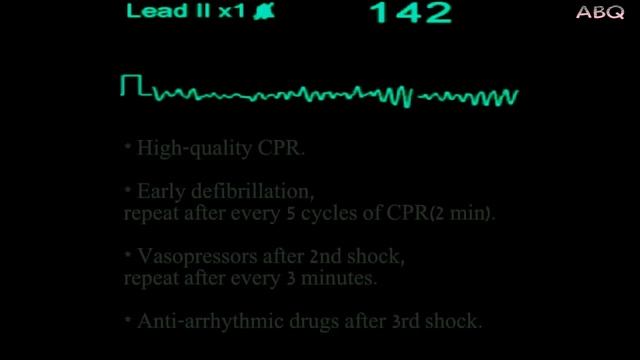 ACLS - ECG rhythm recognition & management, Part 1 смотреть онлайн