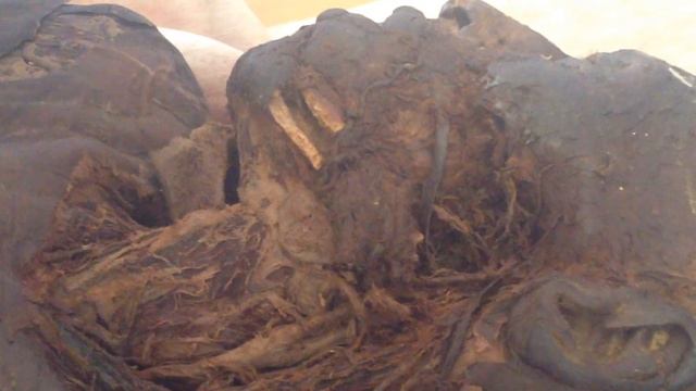 Аорта, дуга аорты, наружная сонная артерия и её ветви. смотреть онлайн