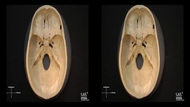 Anatomie 3D de l'étage moyen de la base du crâne смотреть онлайн