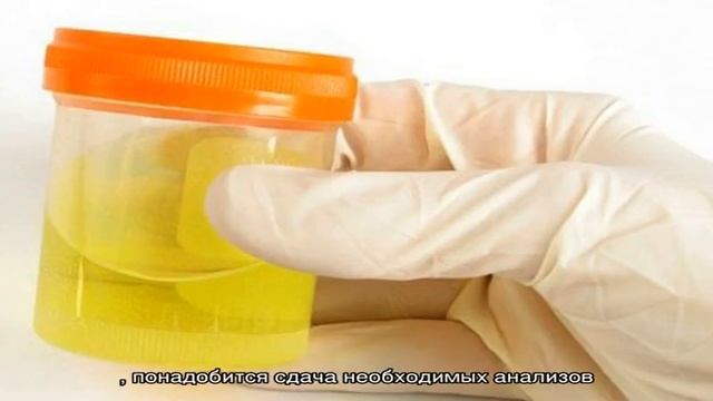 Посев мочи на стерильность смотреть онлайн