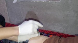 укол в ягодицу. внутримышечная инъекция