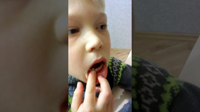 У Саймана зуб качается смотреть онлайн